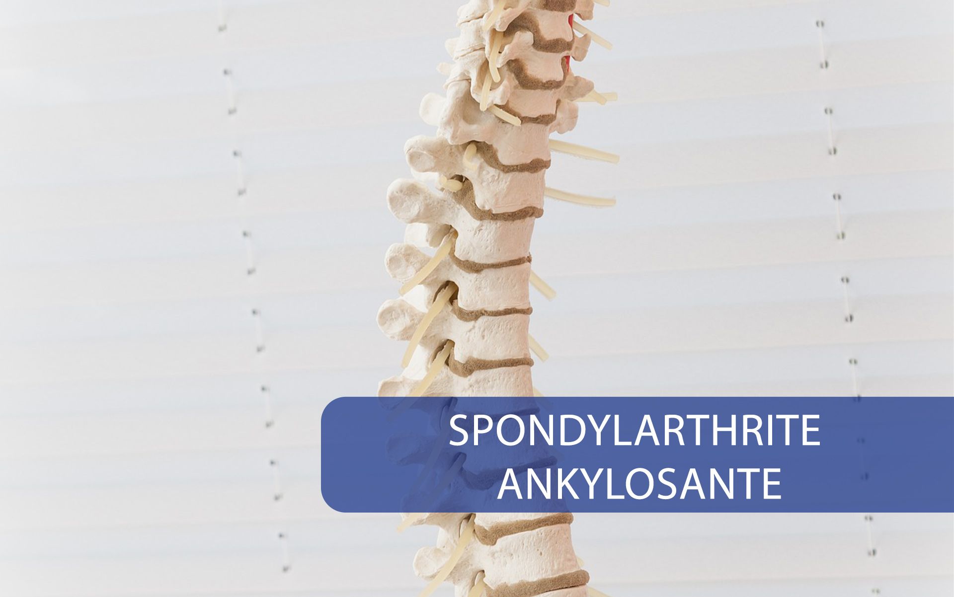 Spondylarthrite Ankylosante