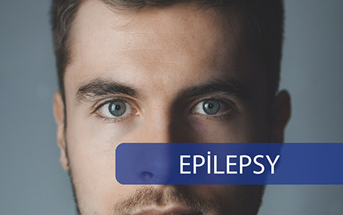 Epılepsy