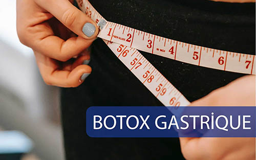 Botox Gastrique