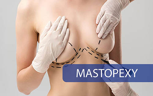 Mastopexy (Meme Dikleştirme Ameliyatı)