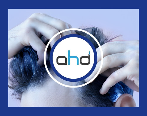 AHD Centro de Trasplante Capilar